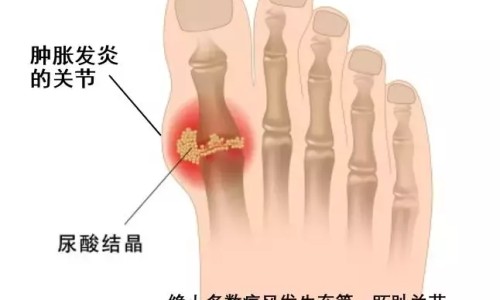 白血病人的衣服要用消毒液洗吗-白血病人摸过的东西可以摸吗专区_白血病人用过的东西还能用吗专区_用白血病人用过的东西网